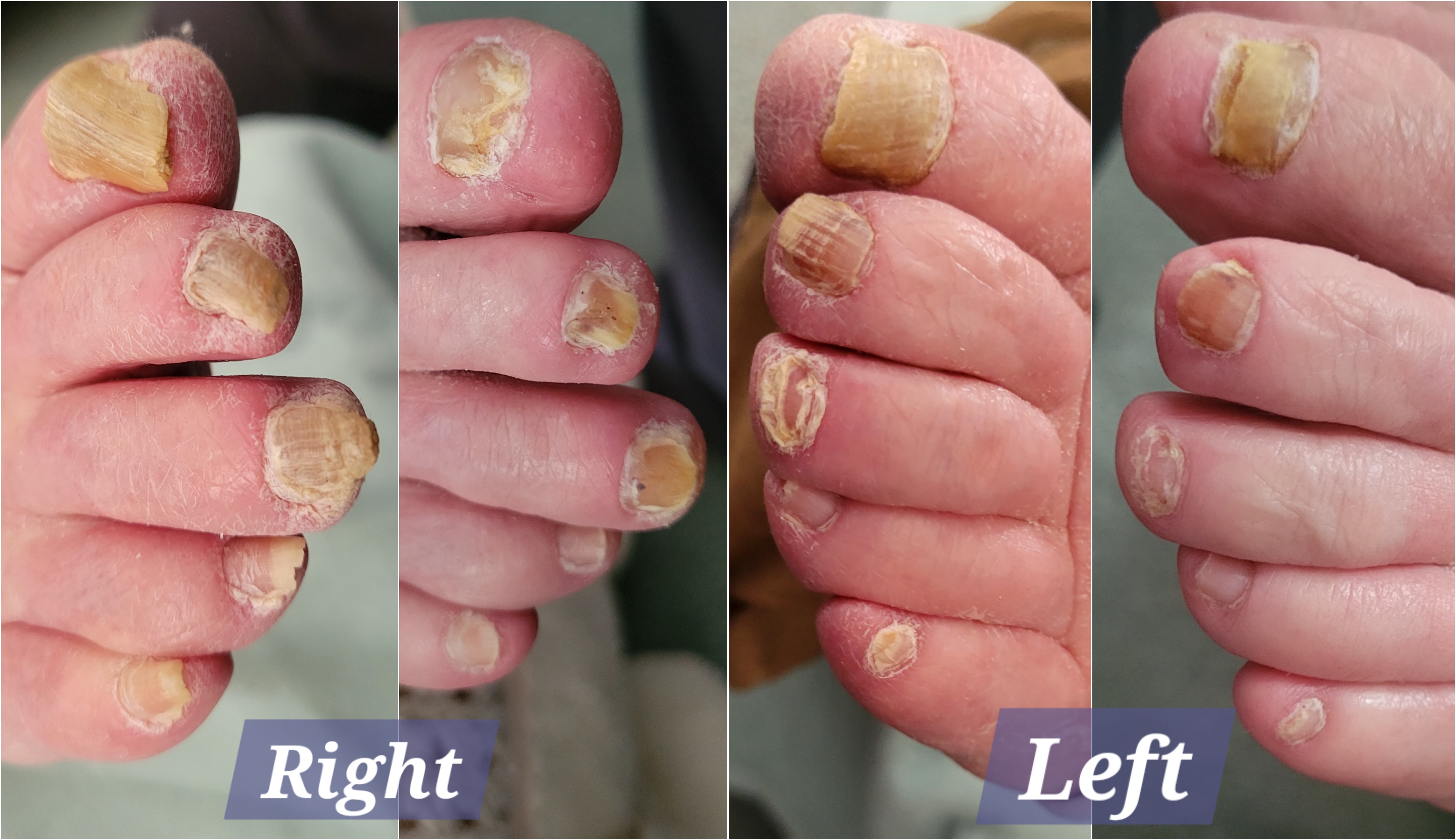 Autonomy PLLC Medical Foot Care photo 5