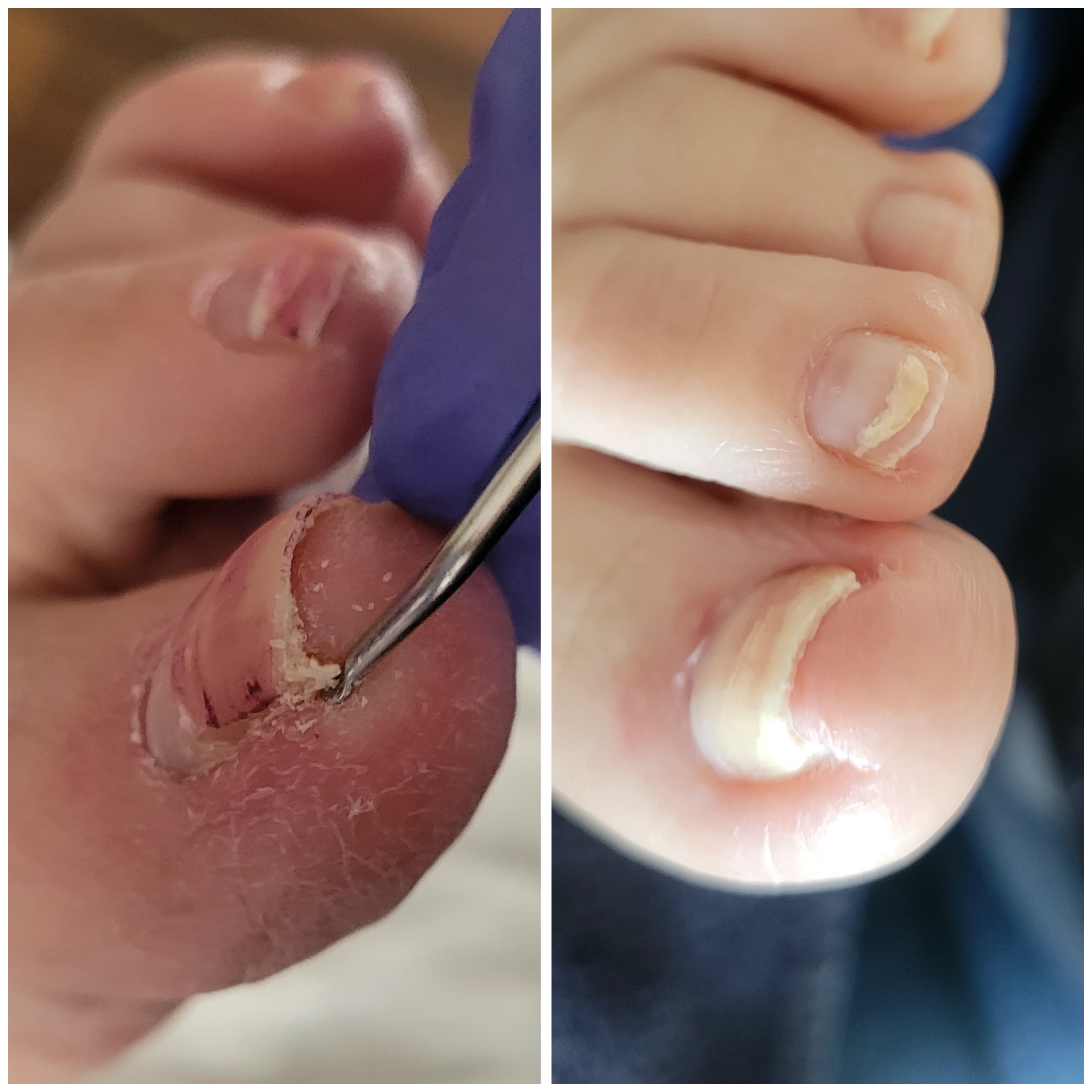 Autonomy PLLC Medical Foot Care photo 4