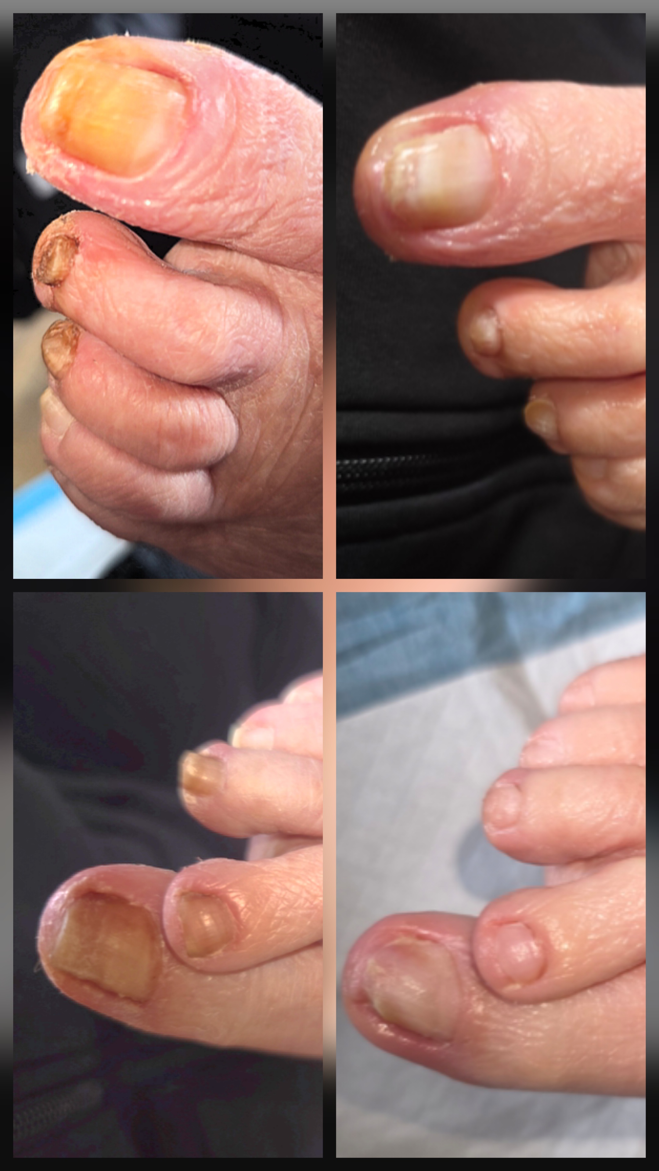 Autonomy PLLC Medical Foot Care photo 1