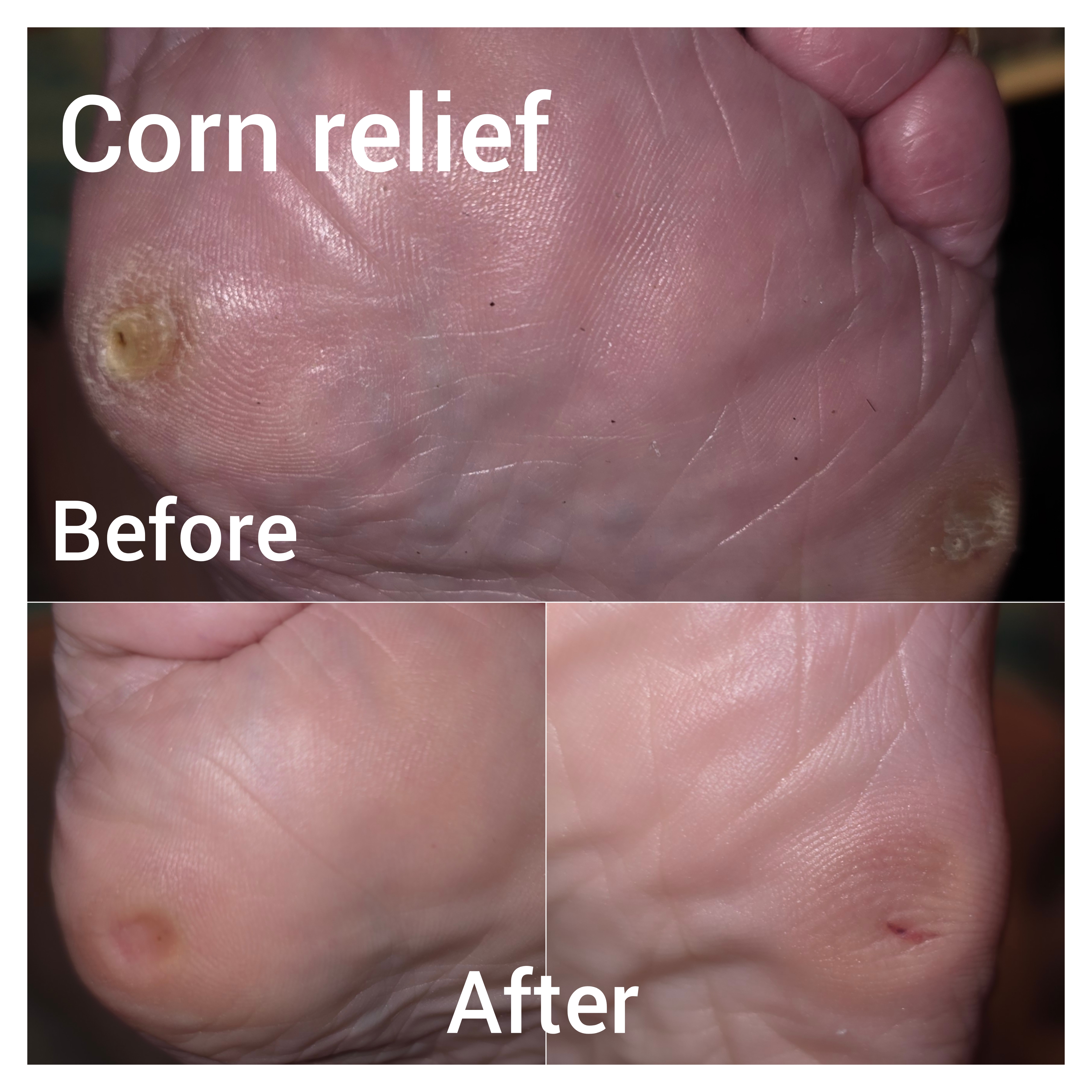 Autonomy PLLC Medical Foot Care photo 2